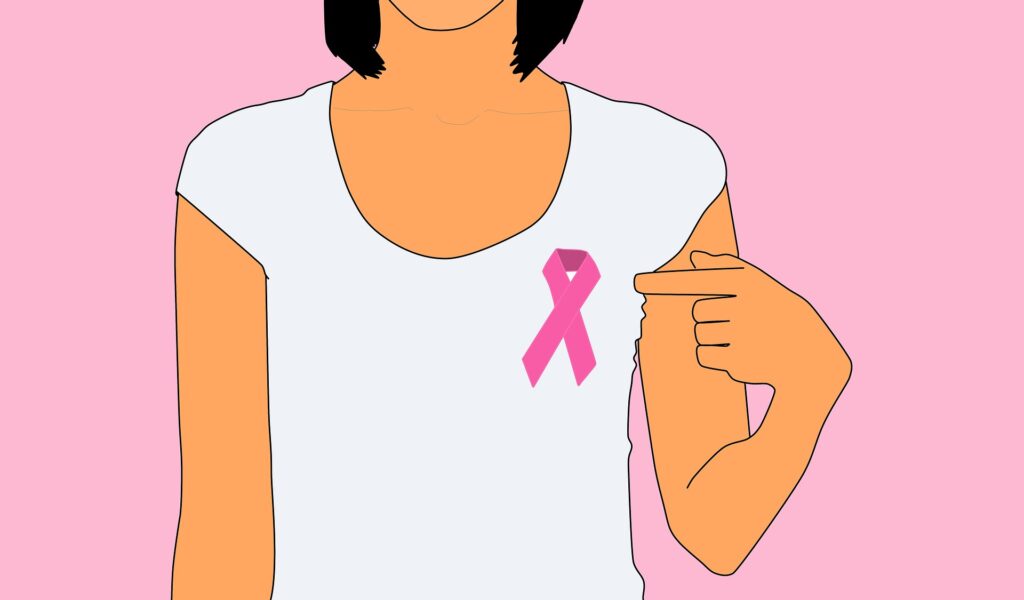 Chimiothérapie pour le cancer du sein