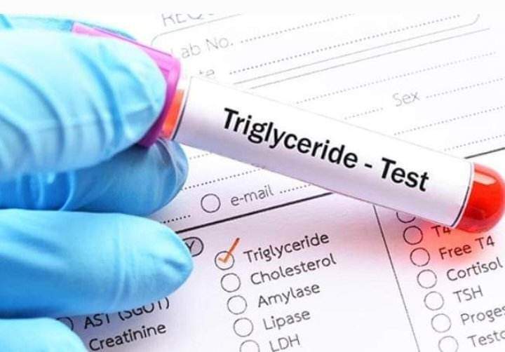 Les triglycérides : comment réduire vos triglycérides ?