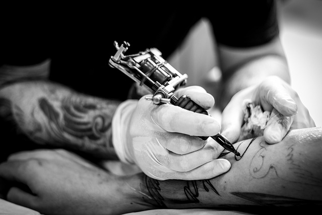 Enlever un tatouage : Tout ce qu'il faut savoir